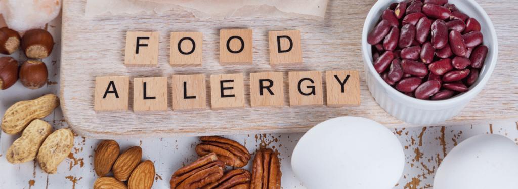 Food Allergies Nutrition Counseling - Food Allergy Dietitian Nutritionist